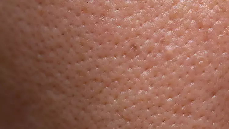 Gözenekli Cilt Görüntüsü