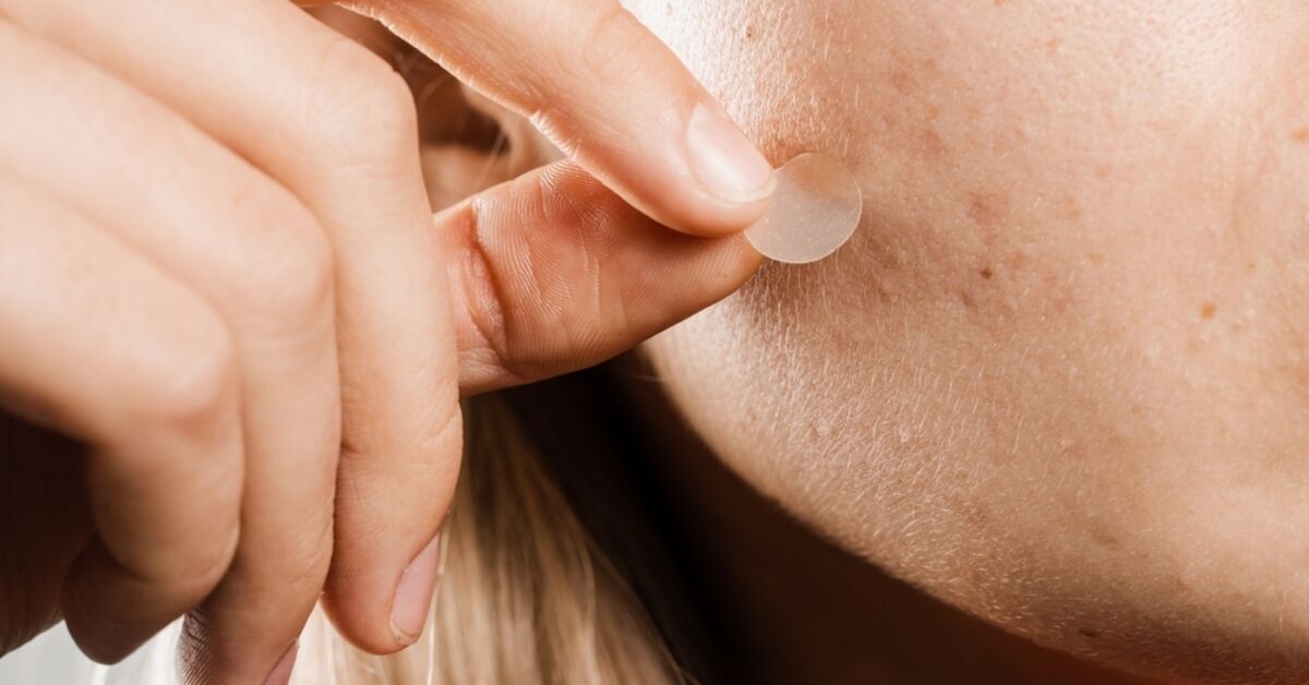 Sivilce Bandı Kullanımı