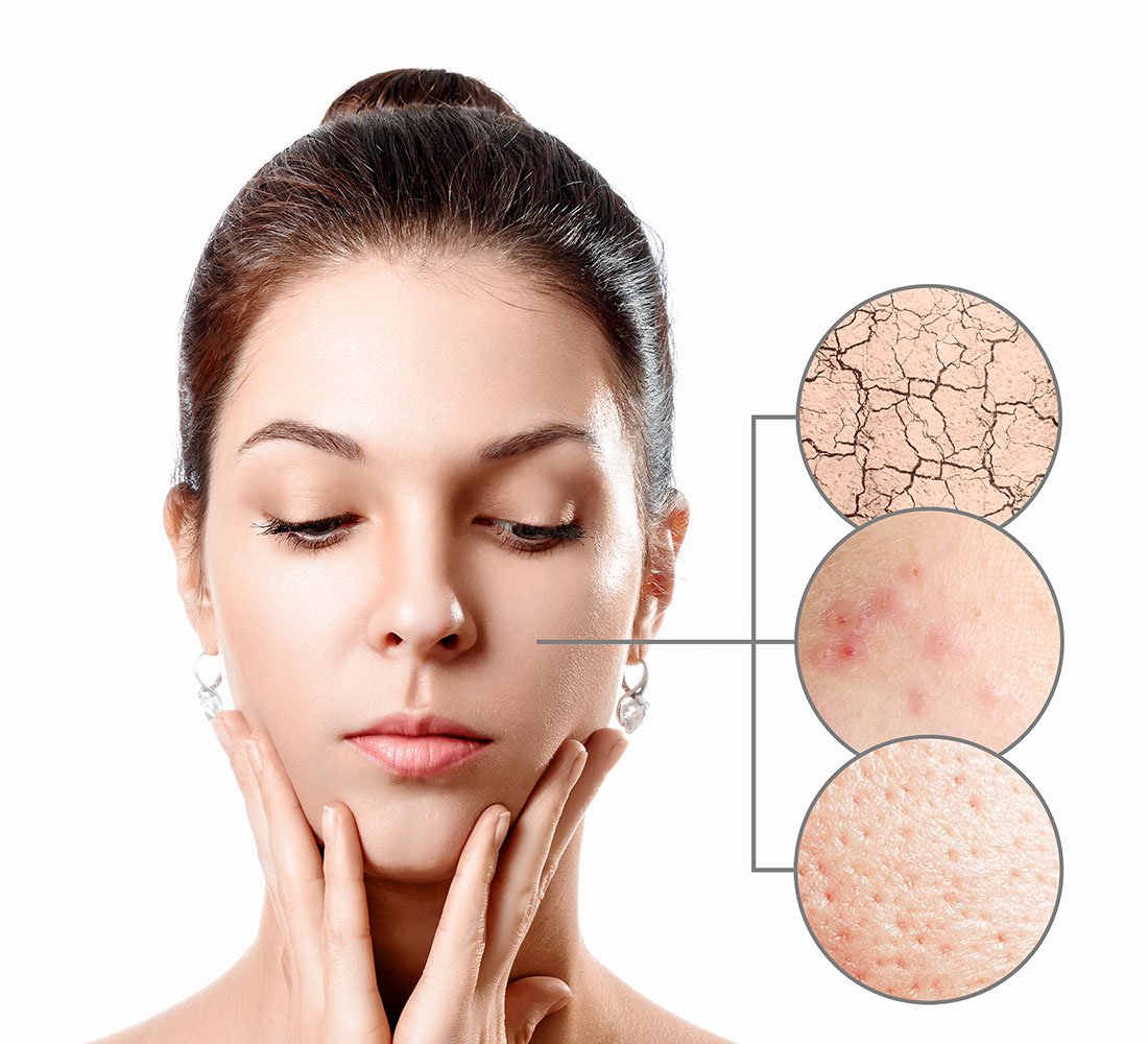 Cilt Lekeleri İçin Doğal Çözümler