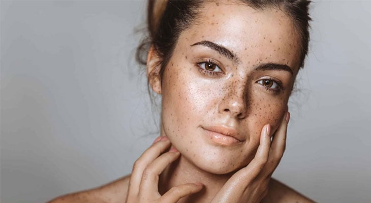 Yüz Lekelerini Yok Etme
