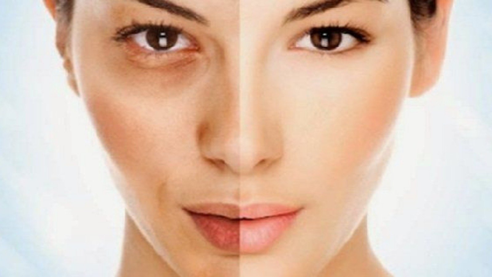 Gözaltı morlukları