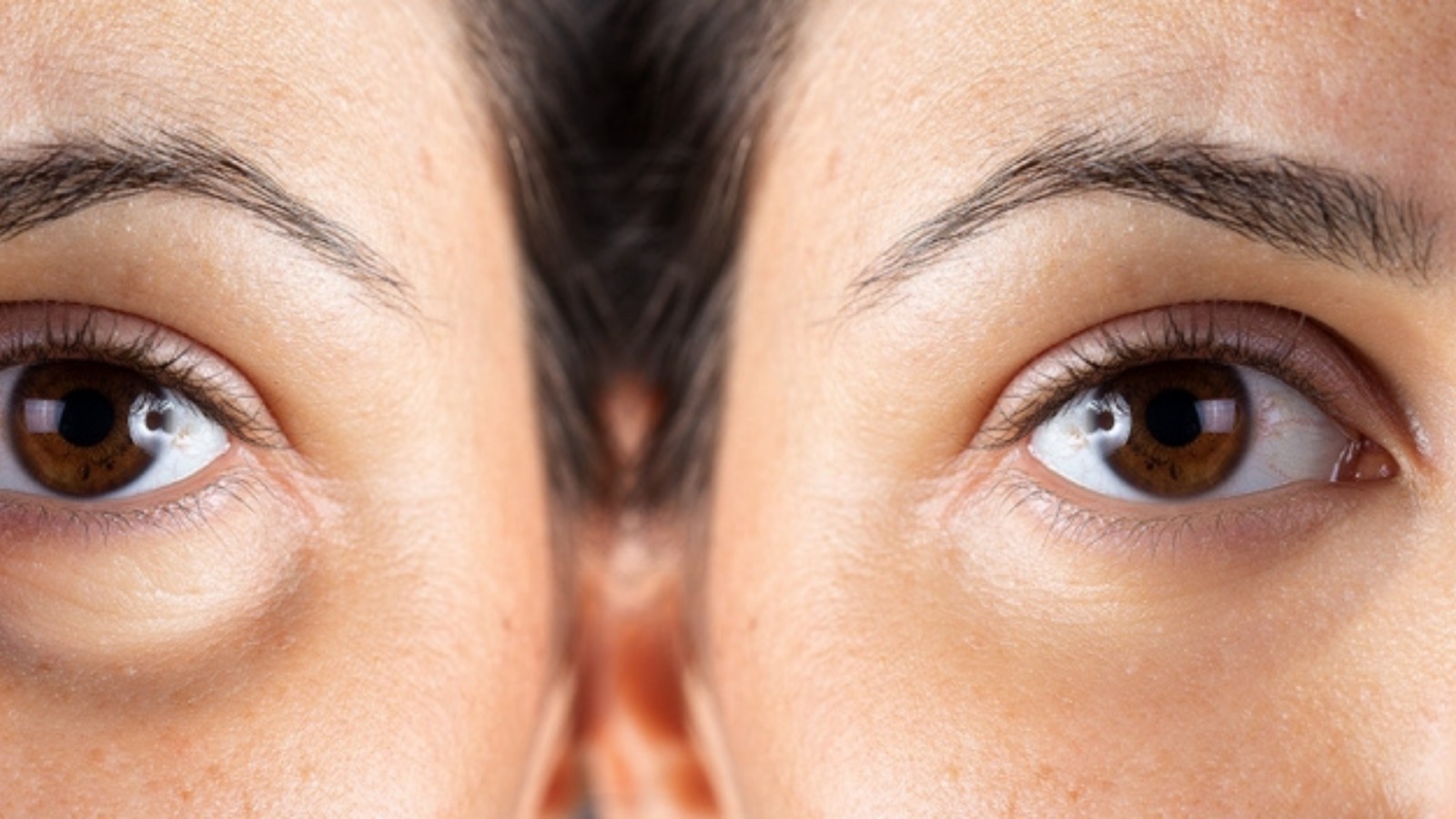 göz altı ışık dolgusu