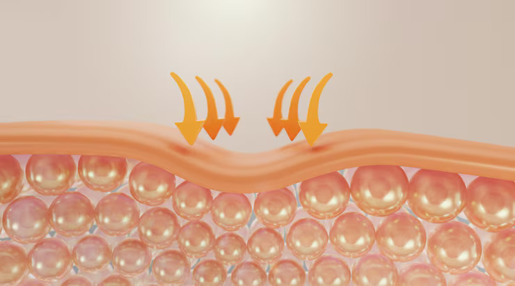 Skin Elasticity